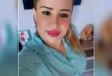 Técnica