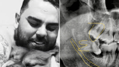 Vendedor morre após retirar dente do siso em clínica de Goiânia