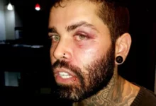 Warley Carvalho denuncia que foi agredido por policial militar em Senador Canedo, Goiás — Foto: Reprodução/Arquivo pessoal