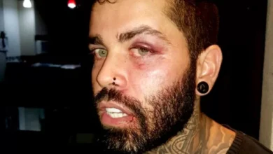 Warley Carvalho denuncia que foi agredido por policial militar em Senador Canedo, Goiás — Foto: Reprodução/Arquivo pessoal