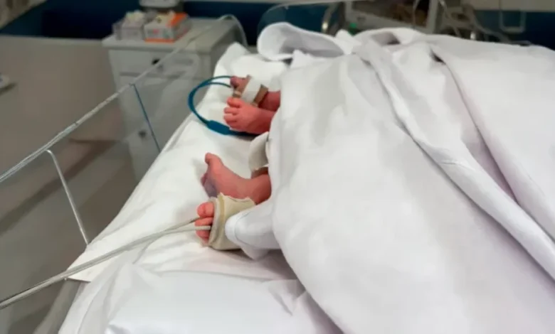 Gêmeos siameses morrem em Goiânia dias antes de cirurgia rara de separação